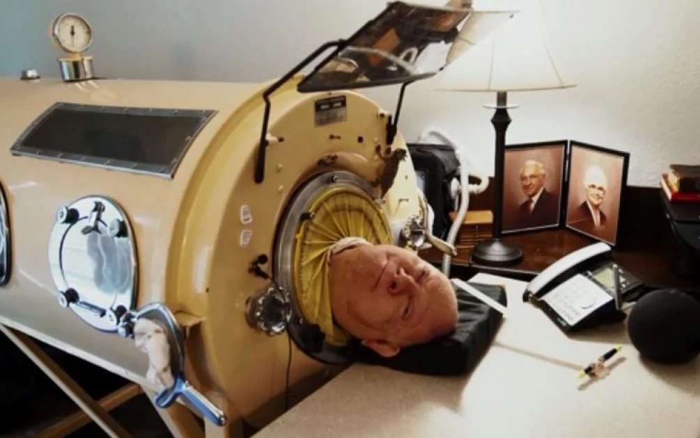 Man who spent most of the past 70 years in an iron lung dies