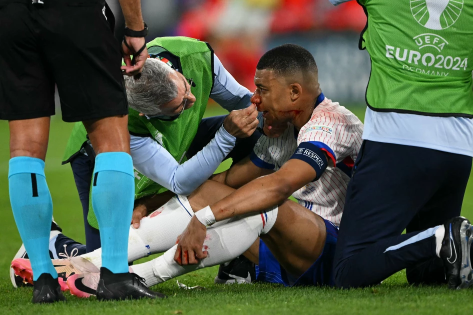 Mbappe breaks nose in France Euro 2024 win Mbappe breaks nose in France Euro 2024 win