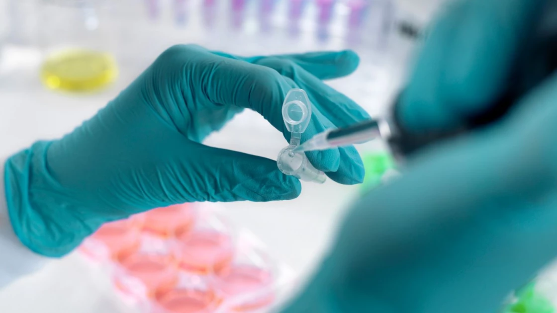 Alarm over rise in advanced HIV among patients living with unmanaged virus Alarm over rise in advanced HIV among patients living with unmanaged virus