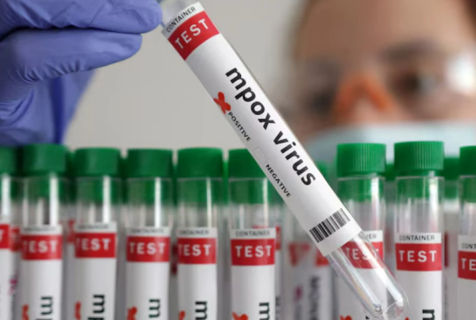 Gov’t plans to spend Ksh.6.7B on Mpox management Gov’t plans to spend Ksh.6.7B on Mpox management