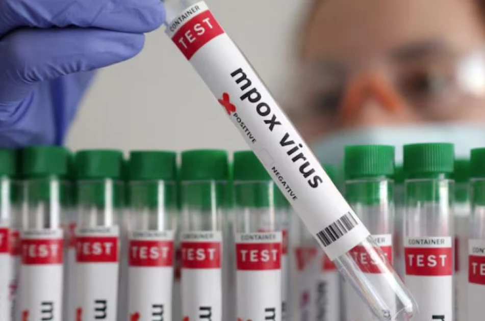 First mpox case detected in Azerbaijan, Interfax reports