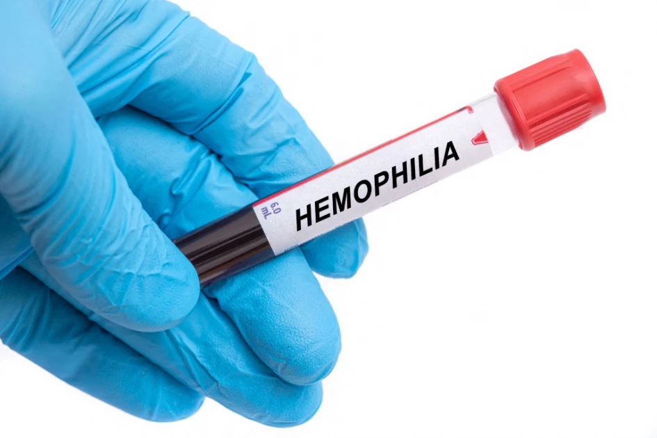 OPINION: The need for awareness, support, and advocacy for people affected by haemophilia OPINION: The need for awareness, support, and advocacy for people affected by haemophilia