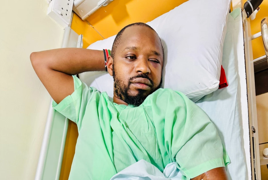 Activist Boniface Mwangi says assaulted, robbed by Nairobi cops Activist Boniface Mwangi says assaulted, robbed by Nairobi cops