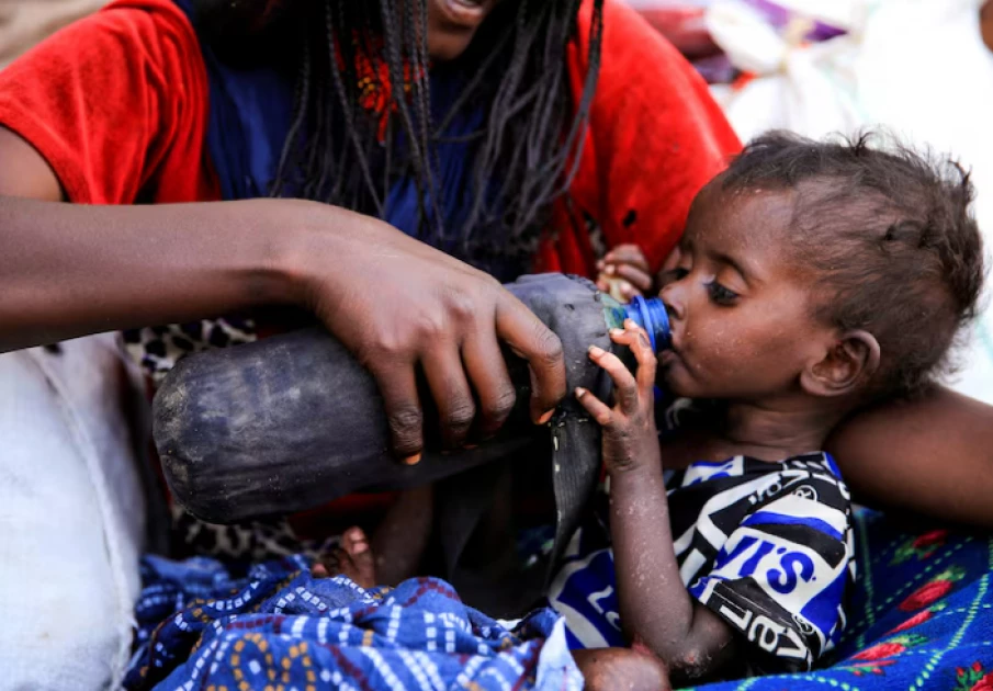 Malnutrition treatments halted in Ethiopia due to underfunding, WFP says Malnutrition treatments halted in Ethiopia due to underfunding, WFP says