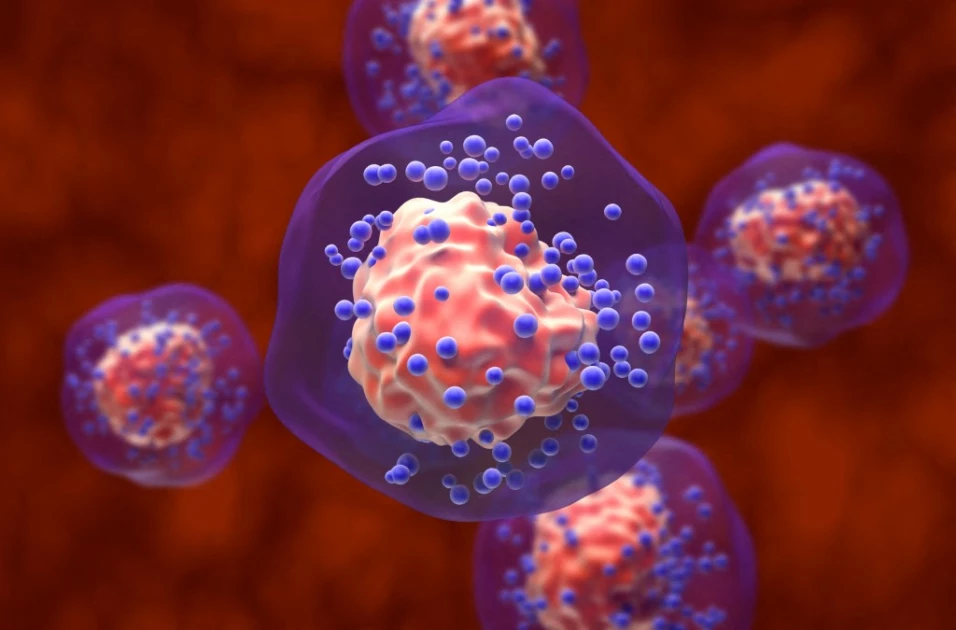 New hope for patients with less common breast cancer