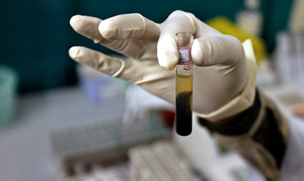 OPINION: Let’s Break It Down: Why Everyone Deserves to Get Tested for Hepatitis