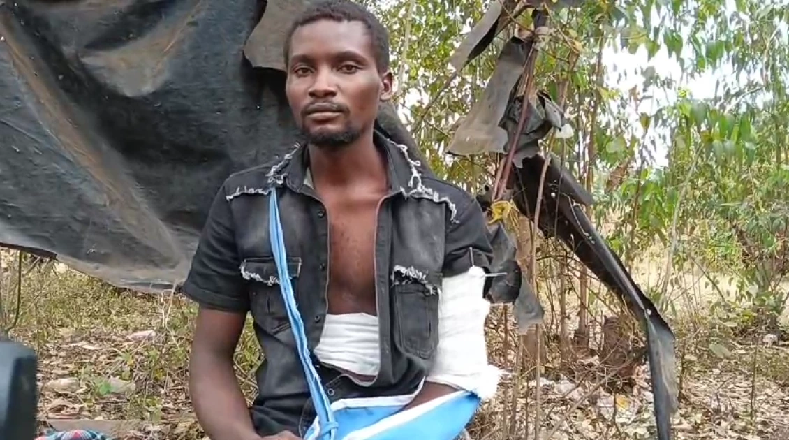 Mwea man seeks justice after gunshot injuries in Saba Saba protest Mwea man seeks justice after gunshot injuries in Saba Saba protest