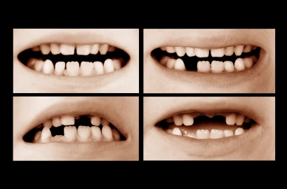 Deadly gum-cutting practice claims lives of infants in Makueni