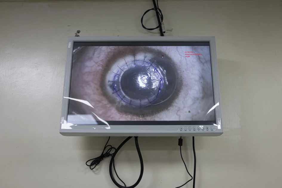 Kenya confronts critical cornea shortage amid cultural resistance