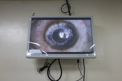 Kenya confronts critical cornea shortage amid cultural resistance