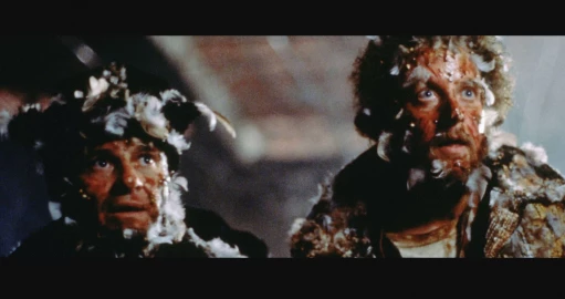 Home Alone’s ‘Wet Bandits’ are medical miracles