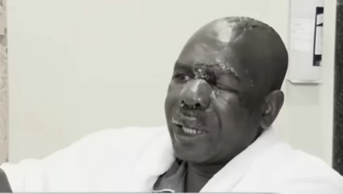 Kenya Editors Guild condemns attack on NMG journalist Habil Kweyu