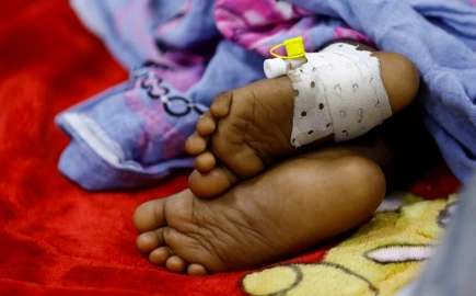 Malnutrition killed over 100,000 children below five years in 2024: Report
