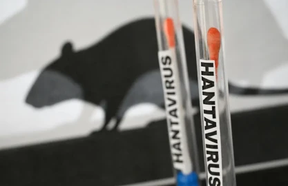18 people in US hantavirus monitoring units, one positive