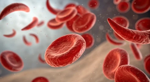 The pain of living with Sickle Cell Disease