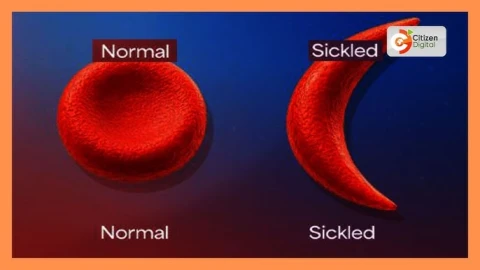  A father’s walk against sickle cell disease