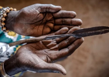 Misleading FGM comparisons downplay harm suffered by millions of women and girls