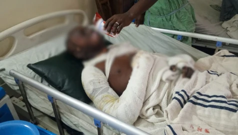 Kirinyaga: 18-year-old survives after being doused with petrol, set ablaze over phone theft